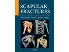 Scapular fractures